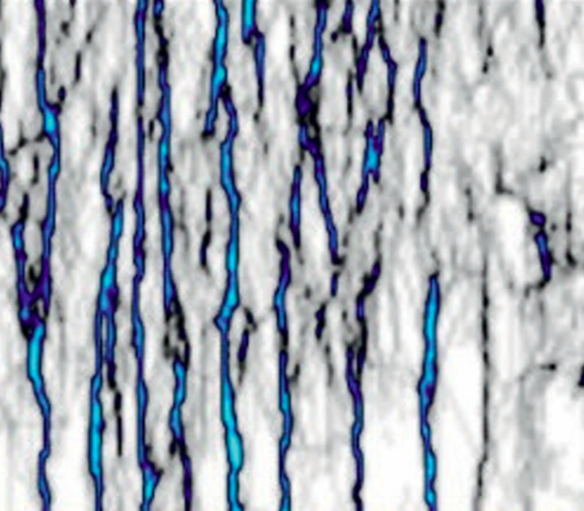 Fracture prediction